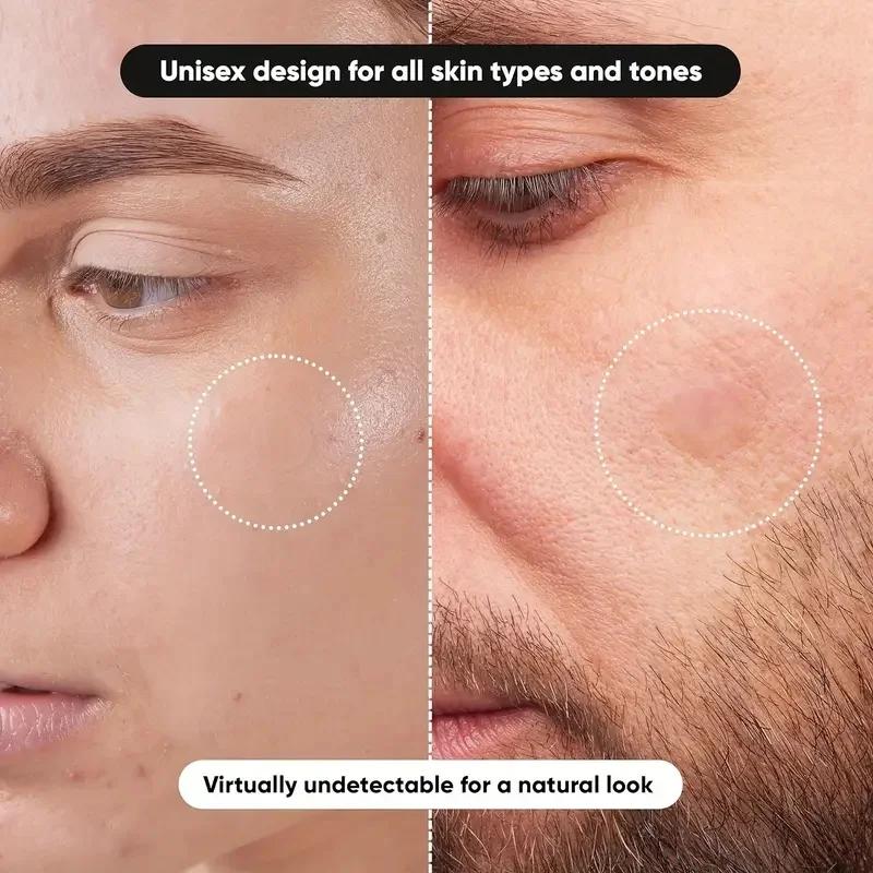 360 шт./кор. пластыри от прыще – обзор и цена Essential Oils